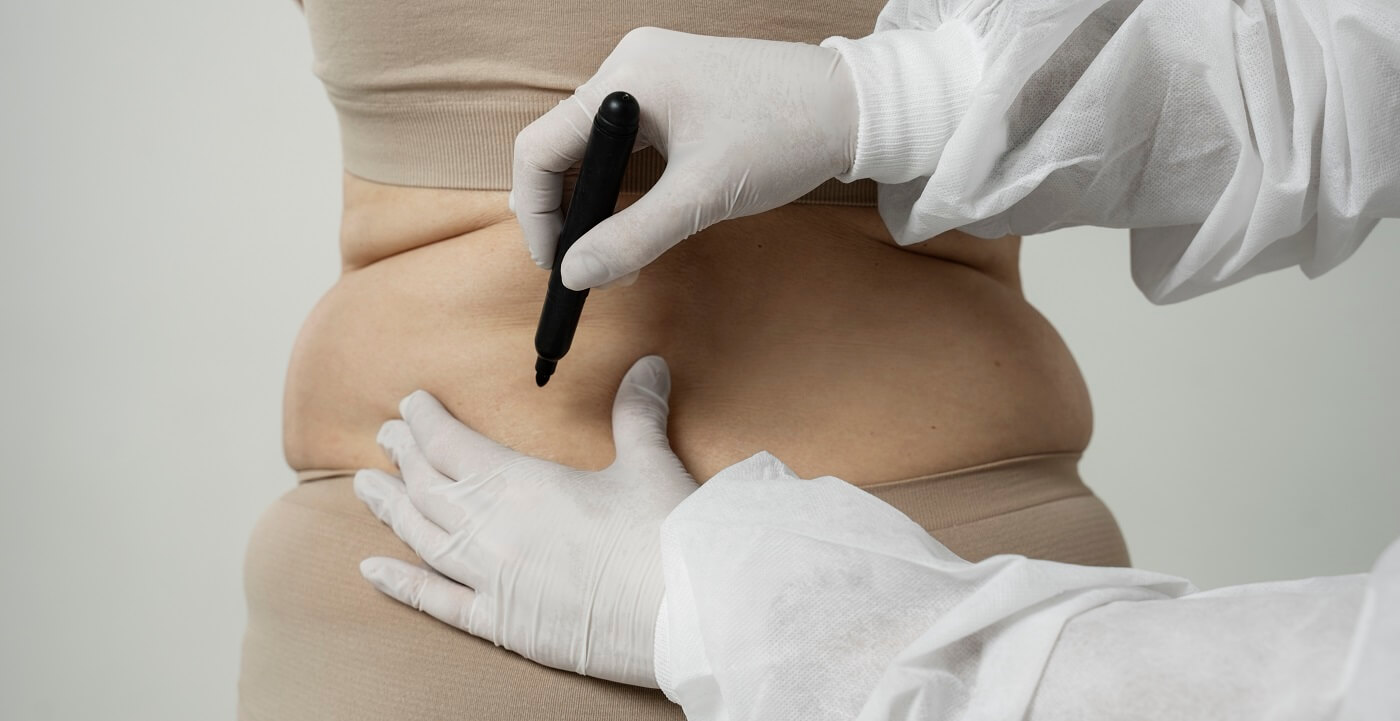 Похудение в косметологической клинике