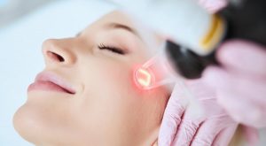 Преимущества профессионального лазерного омоложения кожи